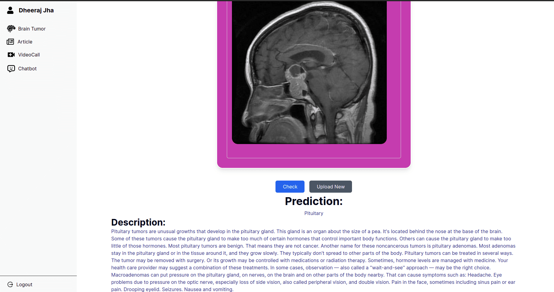 OncoSight for accurate and speedy detection of Brain tumor.